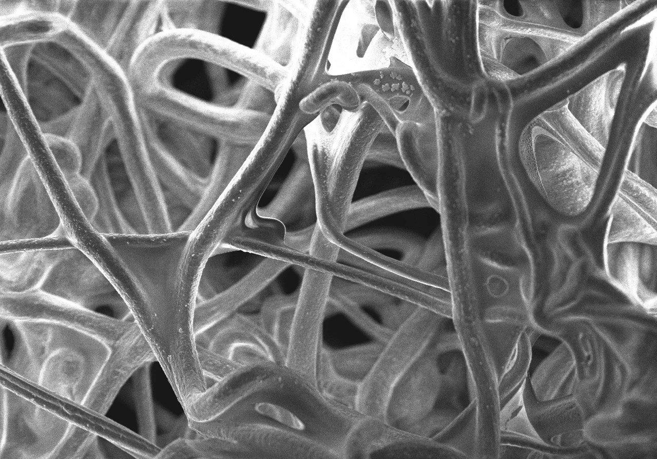Efektyvesniam osteoartrito gydymui – KTU ir LSMU mokslininkų patentuota technologija, padedanti atkurti pažeistą kremzlę